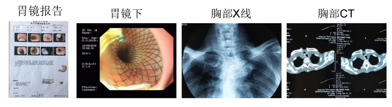 內鏡創(chuàng)新工作永遠在路上(圖5)