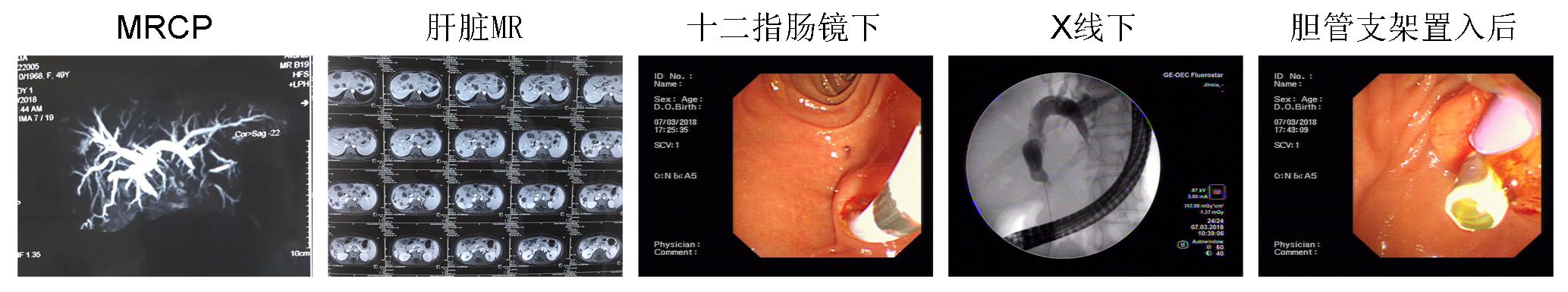 內鏡創(chuàng)新工作永遠在路上(圖9)