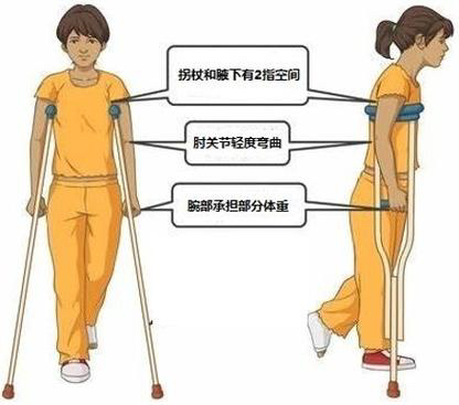 拐杖的“左右為難”——您會正確使用拐杖嗎？(圖4)