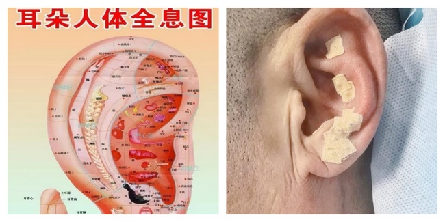 護(hù)理2 (Copy).jpg